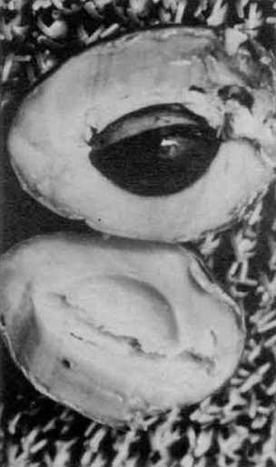 Credit: © W,. F. Whitman, Archives RFC Australia Green sapote produced by my tree have only one seed.