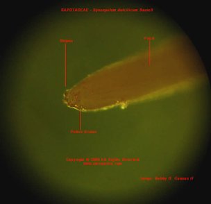 Credit: ©2008 Bobby G Cannon II, quisqualis.com Exposed stigma with pollen on tip