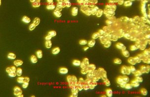 Credit: © 2008 Bob G. CannonII, Quisqualis Pollen grains